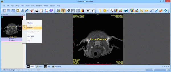 Sante DICOM Viewer Pro Crack With Serial Number